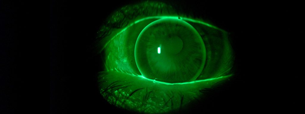 RGP-Corneal-Lens-1280x480-1024x384-1
